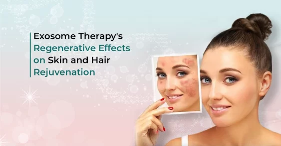 Exosome Therapy’s Regenerative Effects on Skin and Hair Rejuvenation