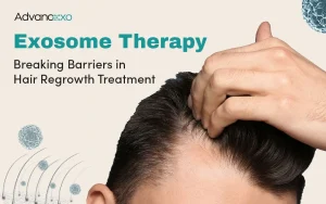 Read more about the article Exosome Therapy: Breaking Barriers in Hair Regrowth Treatment