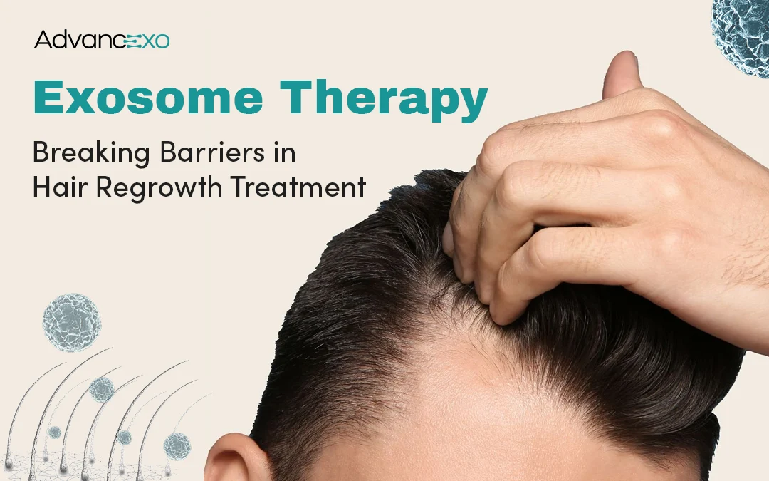 You are currently viewing Exosome Therapy: Breaking Barriers in Hair Regrowth Treatment