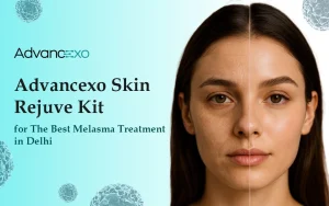 Read more about the article Advancexo Skin Rejuve Kit for The Best Melasma Treatment in Delhi