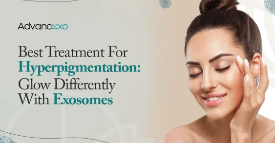 Best Treatment For Hyperpigmentation: Glow Differently With Exosomes