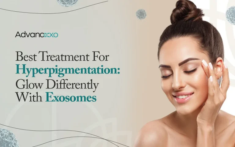 Read more about the article Best Treatment For Hyperpigmentation: Glow Differently With Exosomes