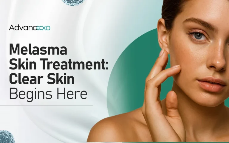 Read more about the article Melasma Skin Treatment​- Clear Skin Begins Here