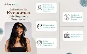 Exosomes-Hair-Regrowth-Treatment