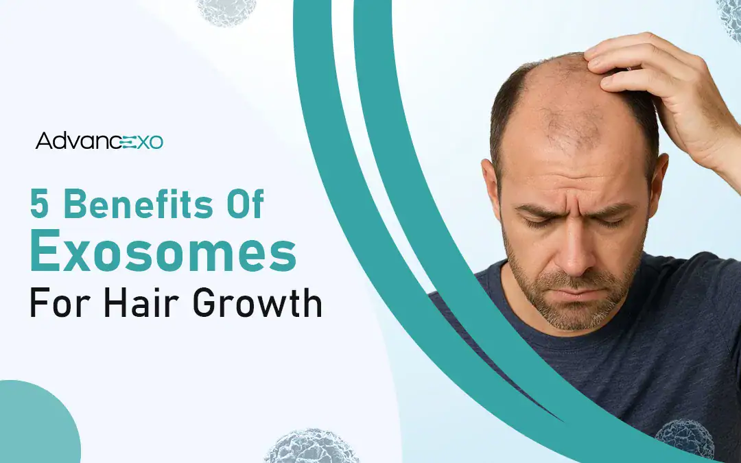 You are currently viewing 5 Benefits of Exosomes for Hair Growth