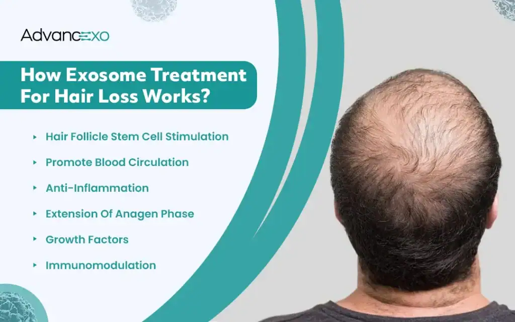 Exosome-Treatment-for-Hair-Loss-Works