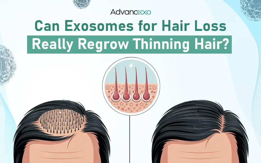 You are currently viewing Can Exosomes for Hair Loss Really Regrow Thinning Hair?