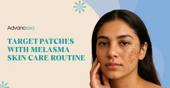 Melasma Skin Care Routine for Better Pigmentation Control