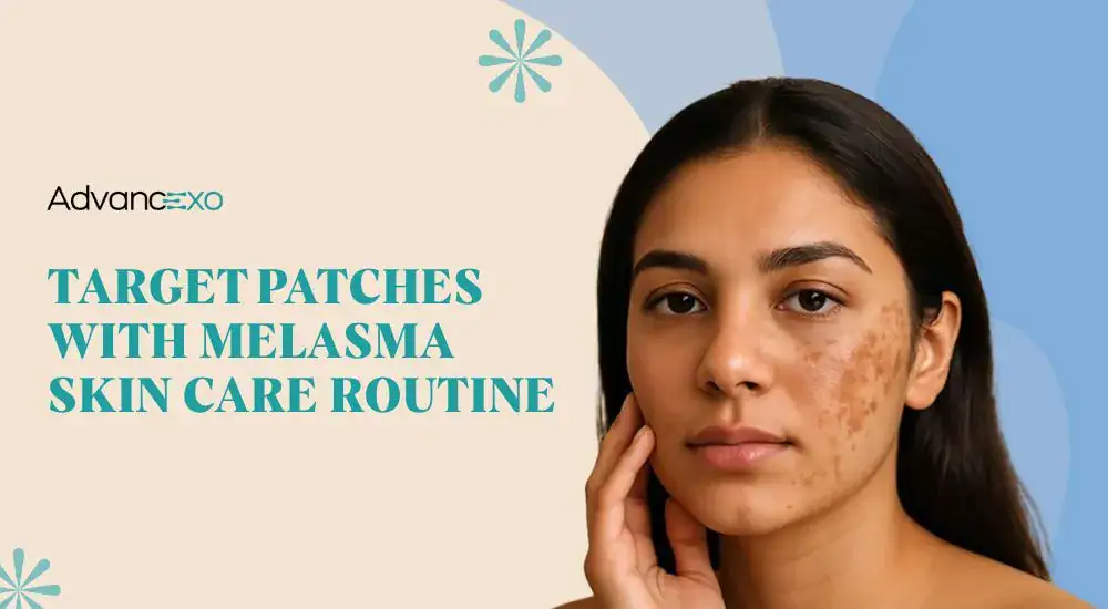 You are currently viewing Melasma Skin Care Routine for Better Pigmentation Control