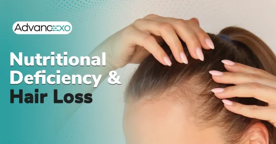 Find Out If Nutritional Deficiency Is Causing Hair Loss