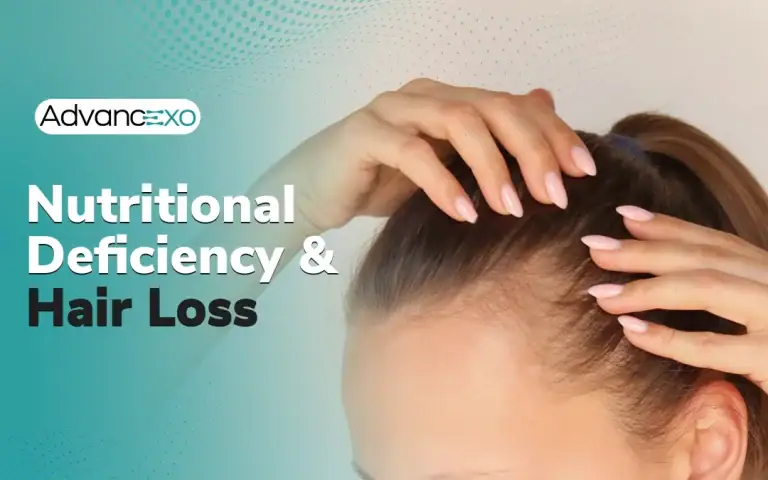 Read more about the article Find Out If Nutritional Deficiency Is Causing Hair Loss