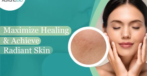 What’s the Best Skin Care After Microneedling for Radiant Skin