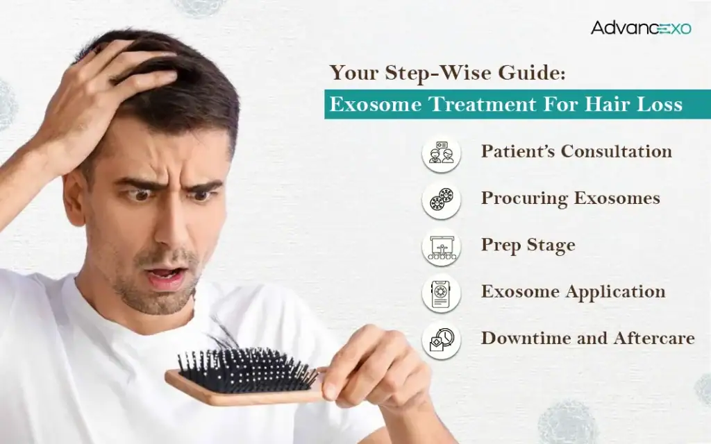 Exosome-Treatment-for-Hair-Loss