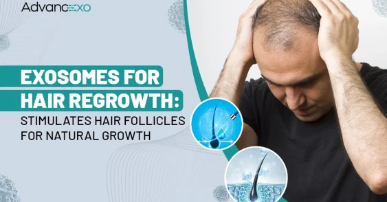 Exosomes for Hair Regrowth: How They Stimulate Growth