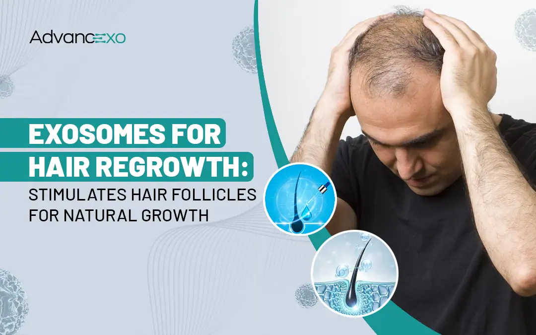 You are currently viewing Exosomes for Hair Regrowth: How They Stimulate Growth
