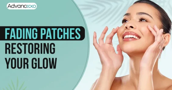 Do Exosomes in Melasma Treatment for Dark Skin Actually Work?