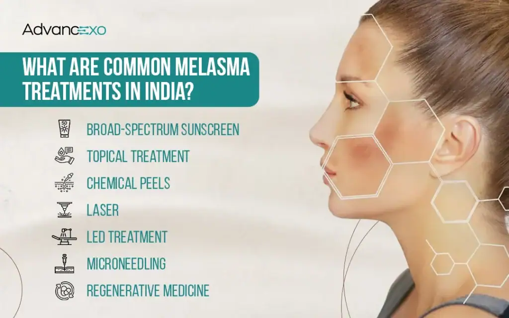 melasma-treatments-in-India