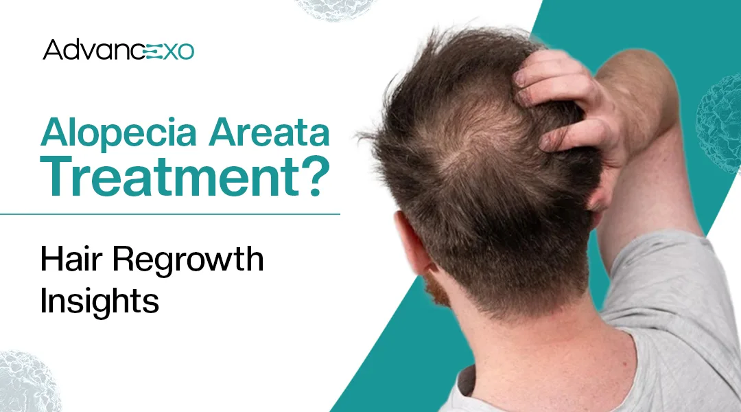 You are currently viewing Can Exosomes Help Restore Hair Growth in Alopecia Areata?
