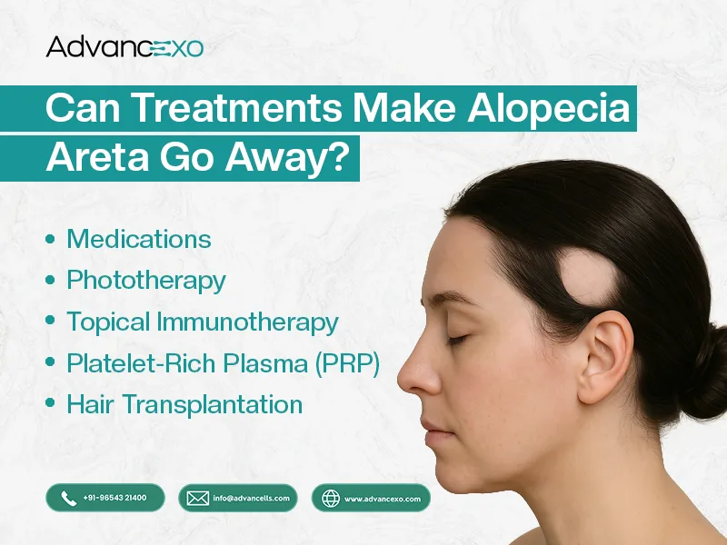 Treatments-Make-Alopecia-Areta