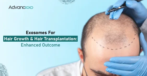 Exosomes for Hair Growth: Can They Boost Hair Transplant Results?
