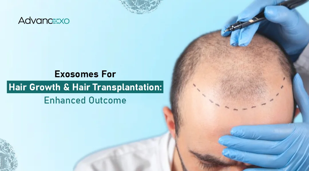 You are currently viewing Exosomes for Hair Growth: Can They Boost Hair Transplant Results?