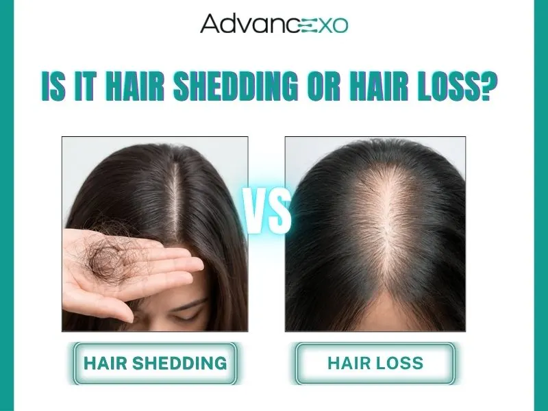Hair-Shedding-or-Hair-Loss