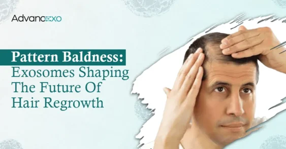 Exosomes for Hair Regrowth: The Science of Pattern Baldness