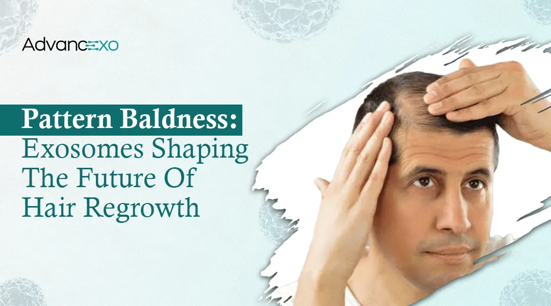 You are currently viewing Exosomes for Hair Regrowth: The Science of Pattern Baldness