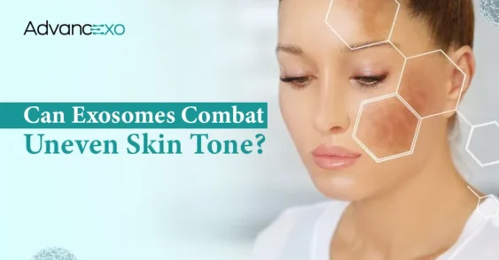 Exosomes: A New Approach to Combat Uneven Skin Tone