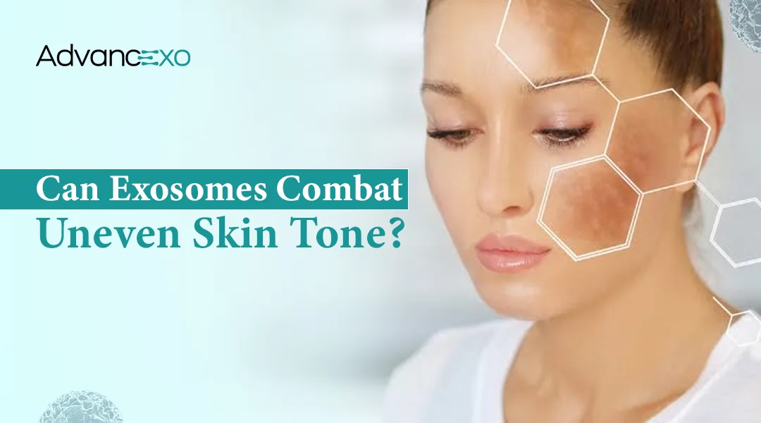 You are currently viewing Exosomes: A New Approach to Combat Uneven Skin Tone