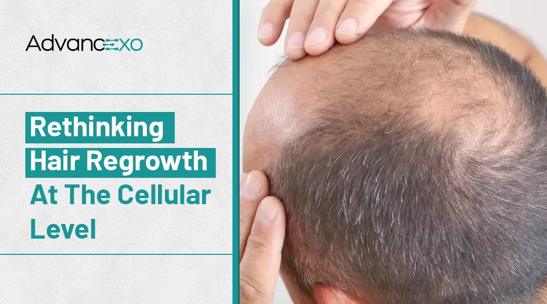 You are currently viewing Can Exosomes for Hair Loss Stimulate Hair Growth?